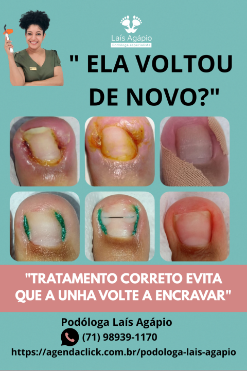 Podóloga Laís Agápio|Podologista|Podólogo|Podologia